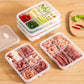 🍏Fridge Fresh-Keeping Compartment Organizer Box