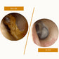 🛡Electric Ear Wax Removal
